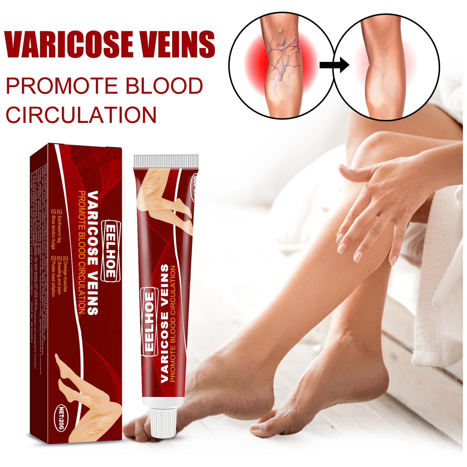 Varicose Veins Treatment Cream