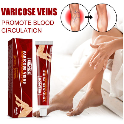 Varicose Veins Treatment Cream