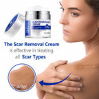 SCAR REMOVAL CREAM