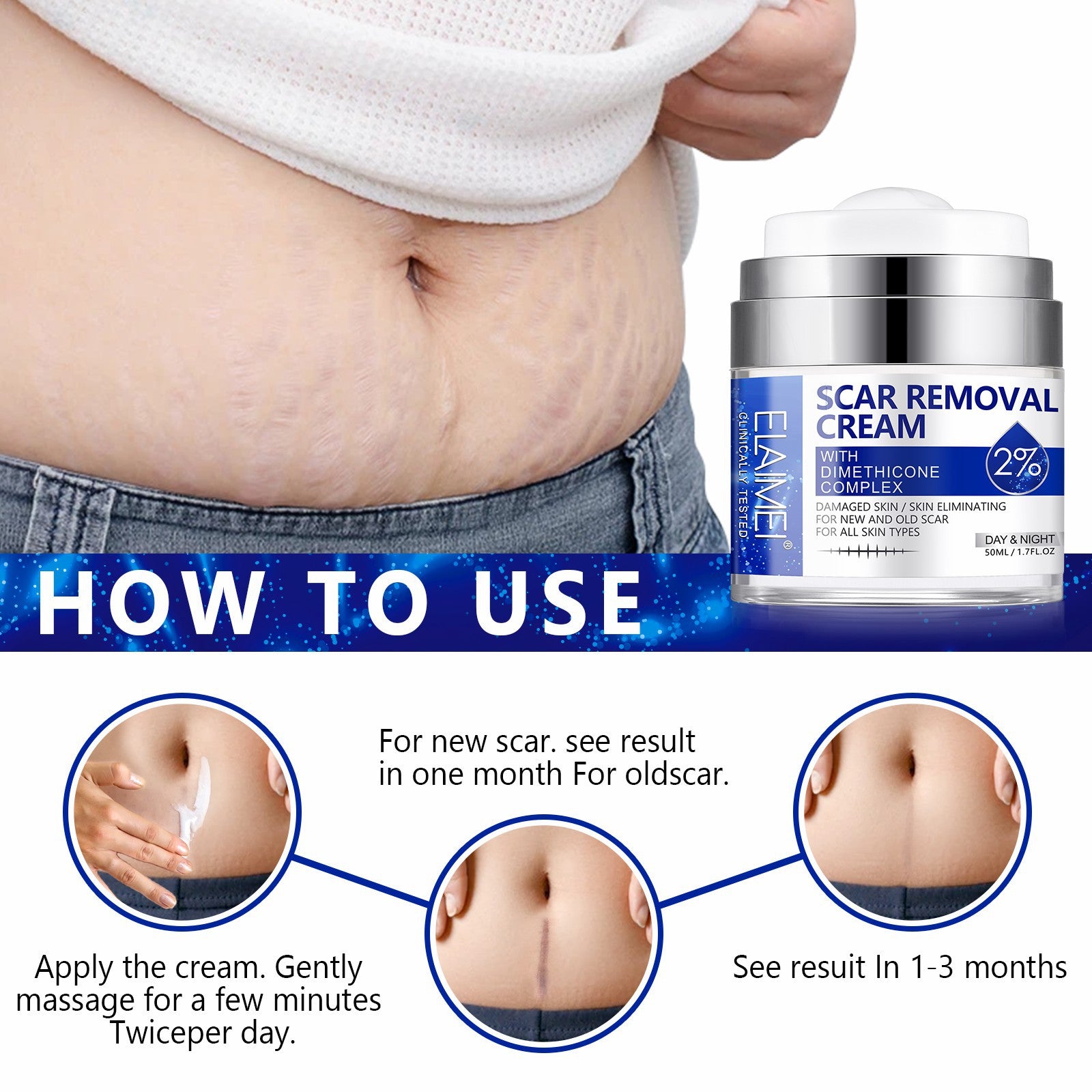 SCAR REMOVAL CREAM