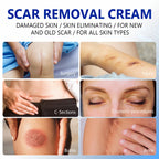 SCAR REMOVAL CREAM